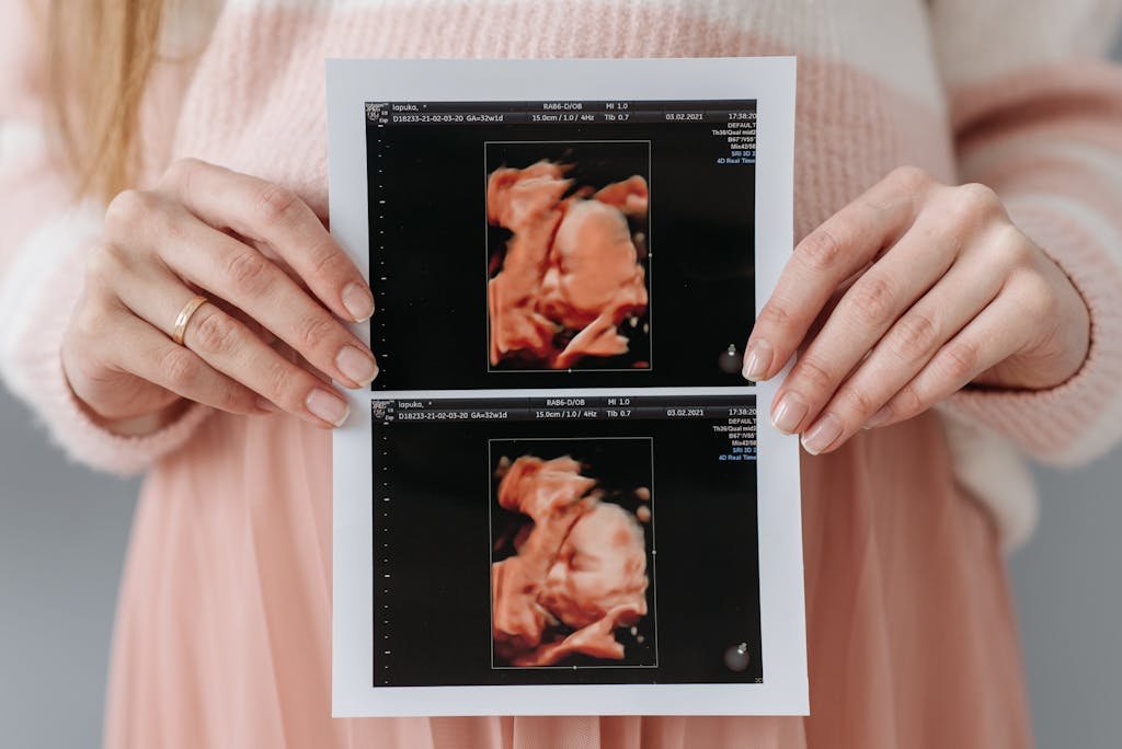 Close Up Of A Pregnant Woman Holding An Ultrasound Printout Symbolizing Anticipation And Maternity Care. 7055918 1024x684